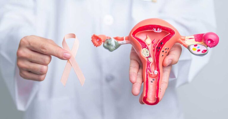 NORDESTE CONCENTRA 42,2% DA INTERNAÇÕES POR MIOMAS NO BRASIL
